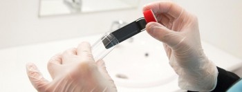 HYGICULT  E/B GUR (Enterobacterias y E.coli) 10u.